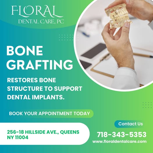 Bone Grafting: Rebuilding Jawbone Strength for Successful Dental Implants